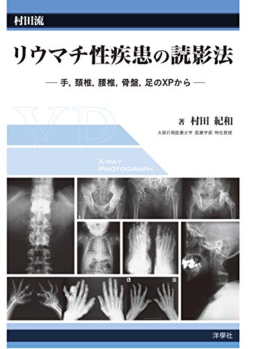 未使用】 村田流 リウマチ性疾患の読影法 手 頚椎 腰椎 骨盤 足のXPからー-